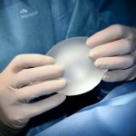 Caso Paloma Nicole: ¿A qué edad se puede hacer una cirugía plástica en México