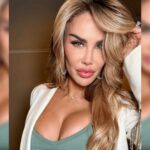 Ninel Conde se somete a cirugía para cambiar el color de sus ojos Ninel Conde se somete a cirugía para cambiar el color de sus ojos